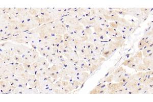 Immunohistochemistry (IHC) image for anti-Nuclear Factor of kappa Light Polypeptide Gene Enhancer in B-Cells Inhibitor, epsilon (NFKBIE) (AA 207-440) antibody (ABIN7439441)