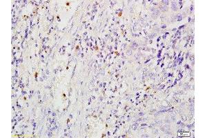 Immunohistochemistry (Paraffin-embedded Sections) (IHC (p)) image for anti-Macrophage Scavenger Receptor 1 (MSR1) (AA 211-320) antibody (ABIN872905)