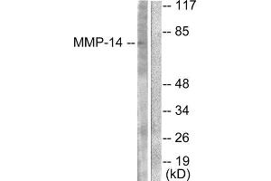 Western Blotting (WB) image for anti-Matrix Metallopeptidase 14 (Membrane-inserted) (MMP14) (C-Term) antibody (ABIN1848674) (MMP14 antibody  (C-Term))