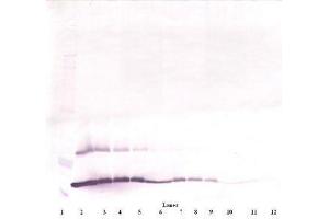 Image no. 2 for anti-Thymic Stromal Lymphopoietin (TSLP) antibody (ABIN465621) (Thymic Stromal Lymphopoietin antibody)