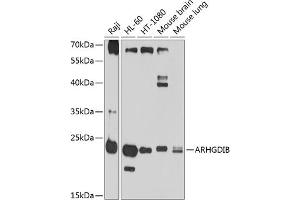 Western blot analysis of extracts of various cell lines, using ARHGDIB antibody (ABIN1678741, ABIN3018028, ABIN3018029 and ABIN6220341) at 1:1000 dilution. (ARHGDIB antibody  (AA 1-201))