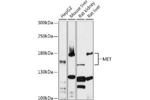 Western blot analysis of extracts of various cell lines, using MET antibody (ABIN1513199, ABIN5663553, ABIN5663555 and ABIN6213594) at 1:1000 dilution. (c-MET antibody  (AA 25-325))