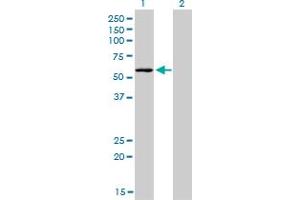 Western Blot analysis of STK38 expression in transfected 293T cell line by STK38 monoclonal antibody (M04), clone 2F3. (STK38 antibody  (AA 365-465))