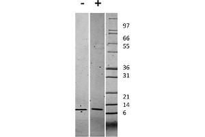 SDS-PAGE (SDS) image for Chemokine (C-X-C Motif) Ligand 1 (Melanoma Growth Stimulating Activity, Alpha) (CXCL1) protein (ABIN6699662)