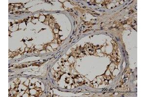Image no. 1 for anti-Regulator of G-Protein Signaling 14 (RGS14) (AA 1-567) antibody (ABIN599517) (RGS14 antibody  (AA 1-567))