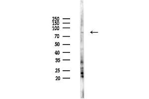 anti-Protein Kinase C, delta (PKCd) (pTyr64) antibody