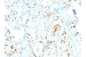 Immunohistochemistry (IHC) image for anti-S100 Calcium Binding Protein A2 (S100A2) antibody (ABIN6940540)