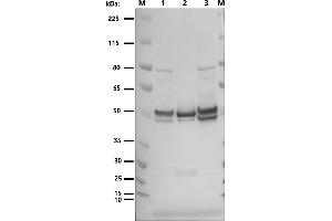 Western blot: anti-NucleoproteinM: M: Marker 1: (ABIN7538787) VLP_SARS-CoV-2 (M+E+N) 2: SARS-CoV-2 nucleoprotein (Sino Biologicals 40588-V08B) 3: (ABIN7538786) VLP_SARS-CoV-2 (S+M+E+N) 1°Antibody: monoclonal rabbit anti-nucleoprotein (Sino Biological 40143-R019) 1:2500 2°Antibody: Goat-anti-Rabbit-HRP (SARS-CoV-2 Spike-, Membrane-, Envelope-, Nucleoprotein protein-VLP)