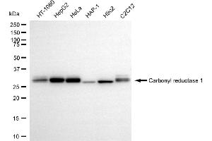 anti-Carbonyl Reductase 1 (CBR1) antibody