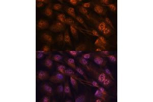 Immunofluorescence analysis of C6 cells using MEK7 antibody (ABIN3023156, ABIN3023157, ABIN3023158 and ABIN6219416) at dilution of 1:100. (MAP2K7 antibody  (AA 1-250))