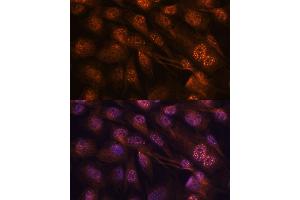 Immunofluorescence analysis of C6 cells using MEK7 antibody (ABIN3023156, ABIN3023157, ABIN3023158 and ABIN6219416) at dilution of 1:100. (MAP2K7 antibody  (AA 1-250))