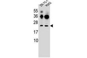FRAT2 antibody  (C-Term)