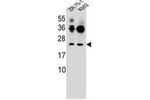 Western blot analysis of FRAT2 Antibody (C-term) in ZR-75-1,K562 cell line lysates (35ug/lane). (FRAT2 antibody  (C-Term))