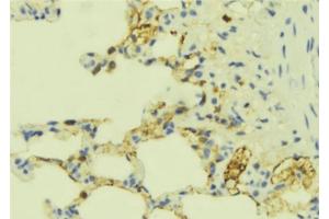 ABIN6277672 at 1/100 staining Mouse lung tissue by IHC-P.