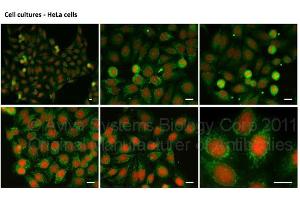 Immunofluorescence (IF) image for anti-Zinc Finger E-Box Binding Homeobox 1 (ZEB1) (N-Term) antibody (ABIN2779631)