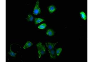 Immunofluorescence staining of MCF-7 cells with ABIN7173988 at 1:100, counter-stained with DAPI. (TYR antibody  (AA 19-377))