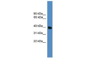 WB Suggested Anti-UBLCP1 Antibody Titration: 0. (UBLCP1 antibody  (N-Term))