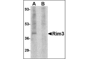 Western blot analysis of Rim3 in human brain tissue lysate with this product at 1 μg/ml in the (A) absence and (B) presence of blocking peptide.