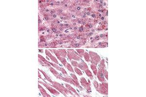 Immunohistochemistry (Formalin/PFA-fixed paraffin-embedded sections) of human liver (A) and human heart (B) tissue with GPR15 polyclonal antibody . (GPR15 antibody  (2nd Extracellular Domain))