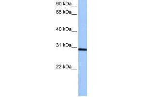 WB Suggested Anti-ASB11 Antibody Titration: 0. (ASB11 antibody  (C-Term))