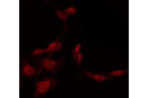ABIN6276215 staining HepG2 by IF/ICC. (SSTR1 antibody  (C-Term))