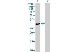 Western Blot analysis of ASB9 expression in transfected 293T cell line by ASB9 MaxPab polyclonal antibody. (ASB9 antibody  (AA 1-294))