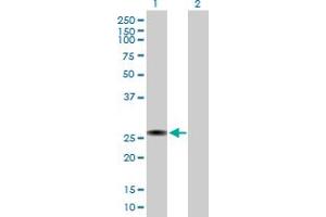 Western Blot analysis of RGS2 expression in transfected 293T cell line by RGS2 MaxPab polyclonal antibody. (RGS2 antibody  (AA 1-211))
