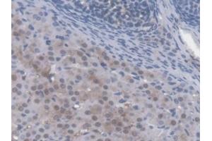 Detection of AMFR in Mouse Ovary Tissue using Polyclonal Antibody to Autocrine Motility Factor Receptor (AMFR) (AMFR antibody  (AA 456-639))