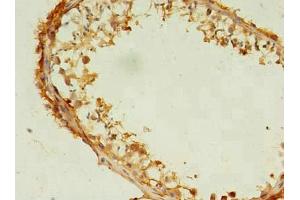 Immunohistochemistry of paraffin-embedded human testis tissue using ABIN7171437 at dilution of 1:100 (CCT6B antibody  (AA 101-330))