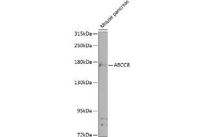 Western blot analysis of extracts of mouse pancreas, using  antibody (ABIN6129856, ABIN6136367, ABIN6136368 and ABIN6224521) at 1:1000 dilution. (ABCC8 antibody  (AA 700-1000))