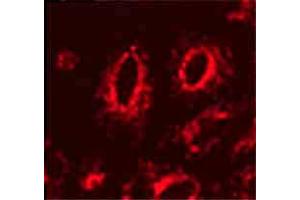 Lamp1 (Ly1C6), IF in transfected HeLa cells  Courtesy of Robert H Edwards, U of Cali, San Fran School of Medicine. (LAMP1 antibody)