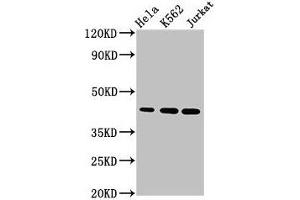 Western Blot Positive WB detected in: Hela whole cell lysate, K562 whole cell lysate, Jurkat whole cell lysate All lanes: PHF6 antibody at 2.