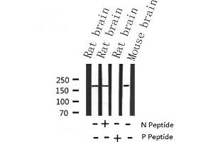 Western blot analysis of Phospho-IRS-1 (Ser639) using Rat brain and Mouse brain tissue extracts (IRS1 antibody  (pSer639))