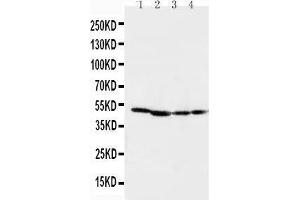 Anti-MEK1 antibody, Western blotting Lane 1: Rat Skeletal Muscle Tissue Lysate Lane 2: Rat Kidney Tissue Lysate Lane 3: CEM Cell Lysate Lane 4: COLO20 Cell Lysate