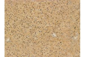 HNRNPA1L2 Mouse Monoclonal Antibody at 1/100 staining rat liver tissue by IHC-P.