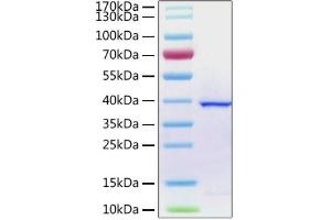 Recombinant 2019-nCoV papain-like protease with His tag was determined by SDS-PAGE with Coomassie Blue, showing a band at 38 kDa. (SARS-CoV-2 NSP3 Protein (AA 1564-1878) (His tag))