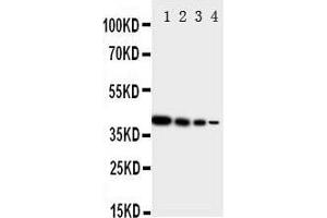 Lane 4: Recombinant Human ERRB4 Protein 1. (ERBB4 antibody  (N-Term))