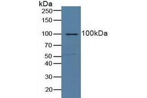 Detection of NCL in Human Lung Tissue using Polyclonal Antibody to Nucleolin (NCL) (Nucleolin antibody  (AA 388-569))