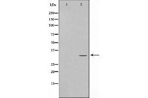 Western blot analysis on Jurkat cell lysate using ELOVL1 Antibody，The lane on the left is treated with the antigen-specific peptide. (ELOVL1 antibody  (Internal Region))