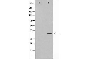 Western blot analysis on Jurkat cell lysate using ELOVL1 Antibody，The lane on the left is treated with the antigen-specific peptide.