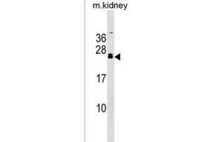 FGF20 Antibody (C-term) (ABIN1536710 and ABIN2838307) western blot analysis in mouse kidney tissue lysates (35 μg/lane). (FGF20 antibody  (C-Term))