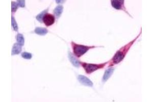 Anti-EDNRB antibody immunocytochemistry (ICC) staining of HEK293 human embryonic kidney cells transfected with EDNRB. (EDNRB antibody  (N-Term))