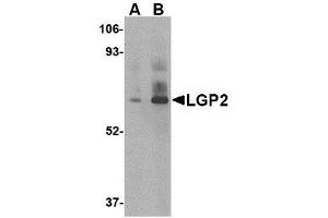 Image no. 1 for anti-DEXH (Asp-Glu-X-His) Box Polypeptide 58 (DHX58) (C-Term) antibody (ABIN1492185) (DHX58 antibody  (C-Term))