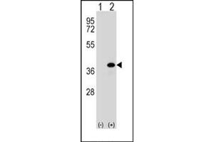 Image no. 2 for anti-Aldo-Keto Reductase Family 1, Member B1 (Aldose Reductase) (AKR1B1) (AA 287-316), (C-Term) antibody (ABIN357880) (AKR1B1 antibody  (C-Term))