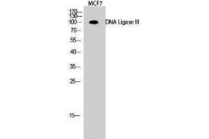 Western Blotting (WB) image for anti-Ligase III, DNA, ATP-Dependent (LIG3) (Internal Region) antibody (ABIN3184322) (LIG3 antibody  (Internal Region))