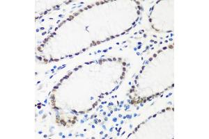 Immunohistochemistry of paraffin-embedded human stomach using HTATSF1 antibody (ABIN5973562) at dilution of 1/100 (40x lens).