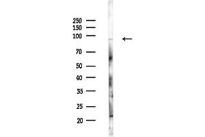 anti-A Kinase (PRKA) Anchor Protein 2 (AKAP2) (N-Term) antibody