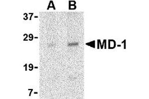 Western Blotting (WB) image for anti-Lymphocyte Antigen 86 (LY86) (Middle Region) antibody (ABIN1030998) (LY86 antibody  (Middle Region))