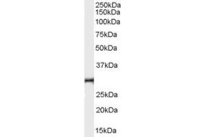 Western Blotting (WB) image for anti-Asteroid Homolog 1 (ASTE1) (C-Term) antibody (ABIN2156411) (ASTE1 antibody  (C-Term))