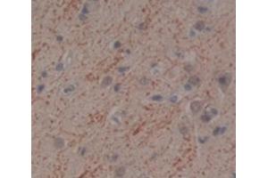 IHC-P analysis of Human Tissue, with DAB staining. (IFNA10 antibody  (AA 24-189))